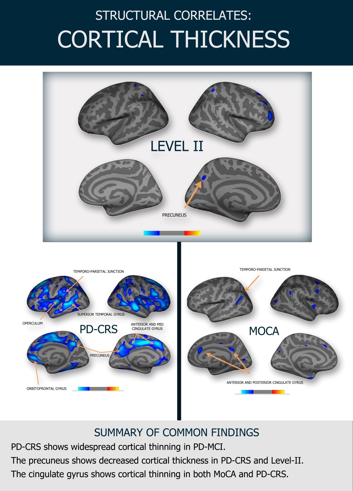 Biais cognitif: Système 1, Système 2 : Neuroprofiler