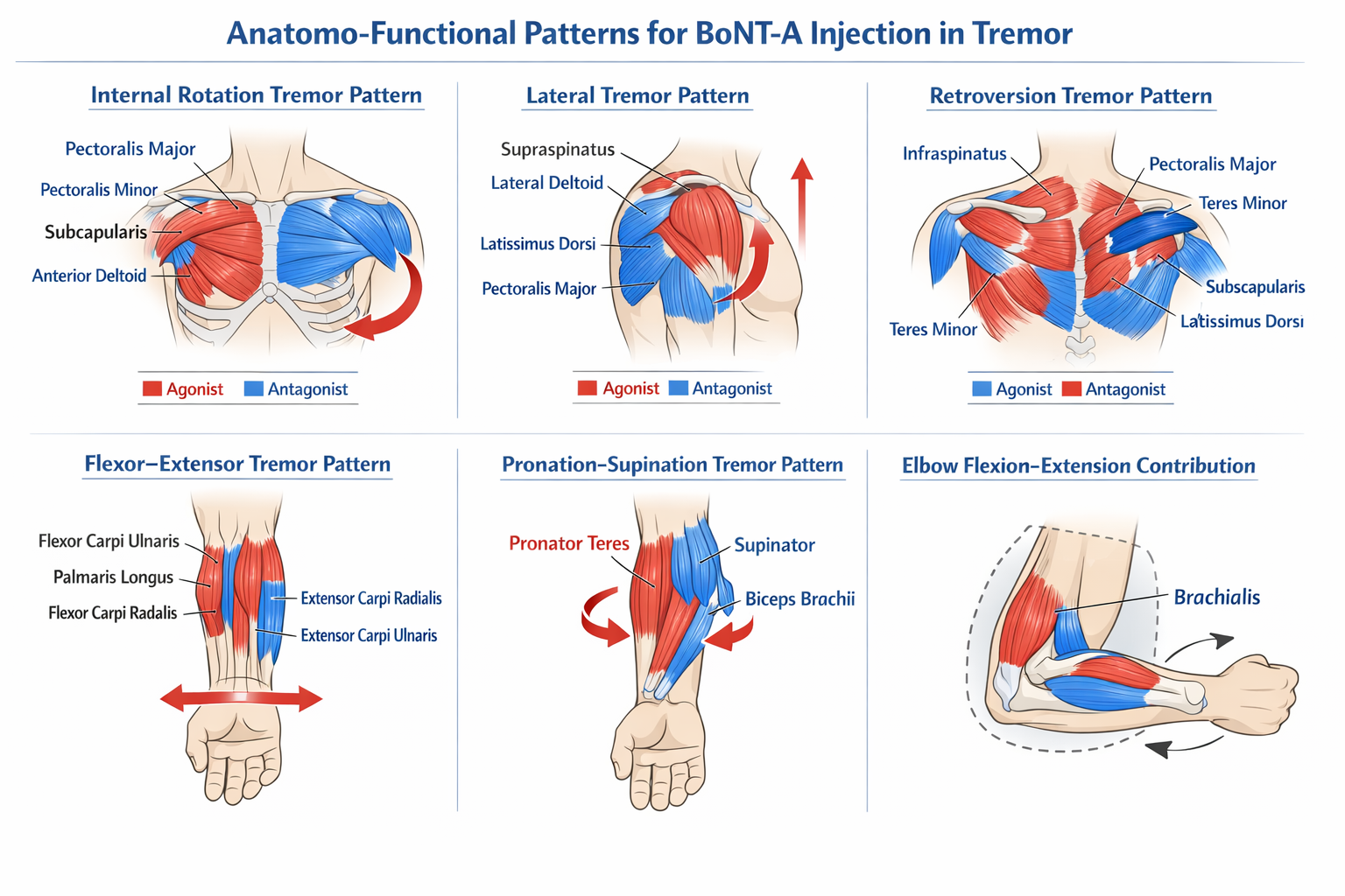 Anatomo-Functional Tremor Patterns