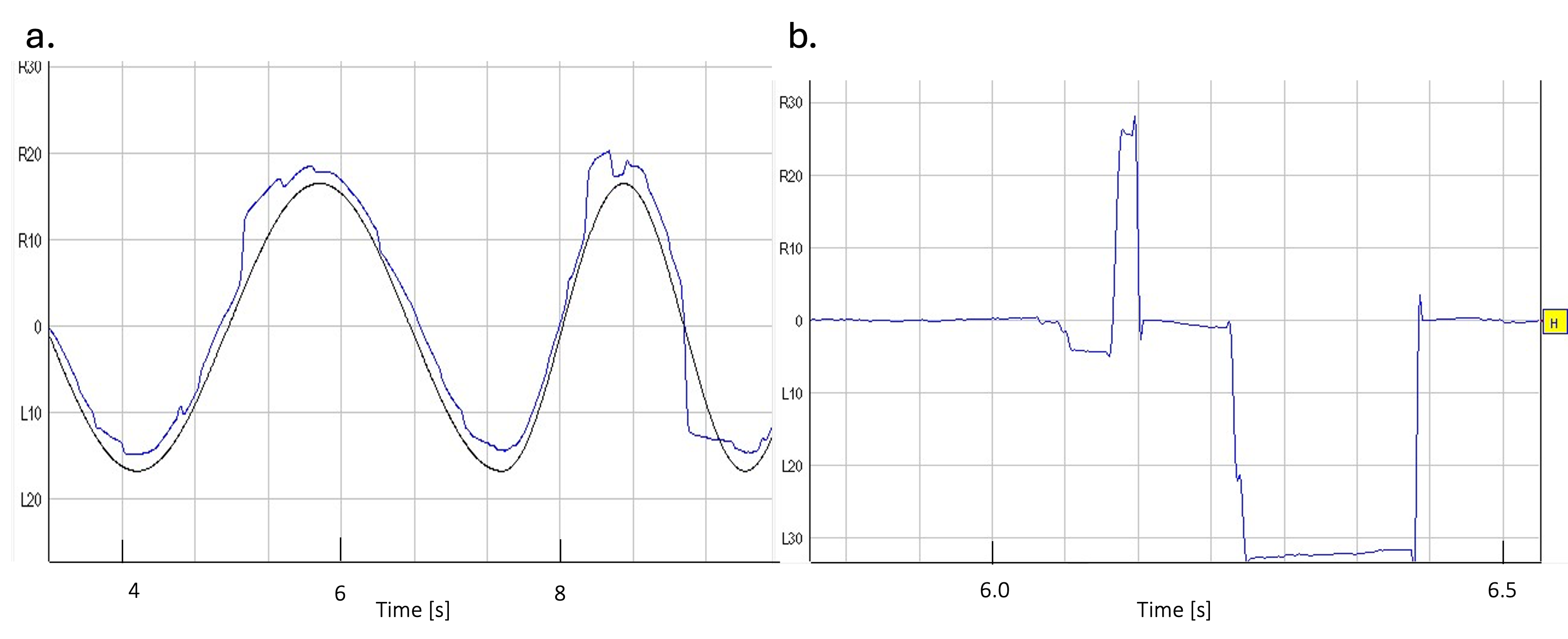 Video-oculography: smooth pursuit(a), fixation(b)