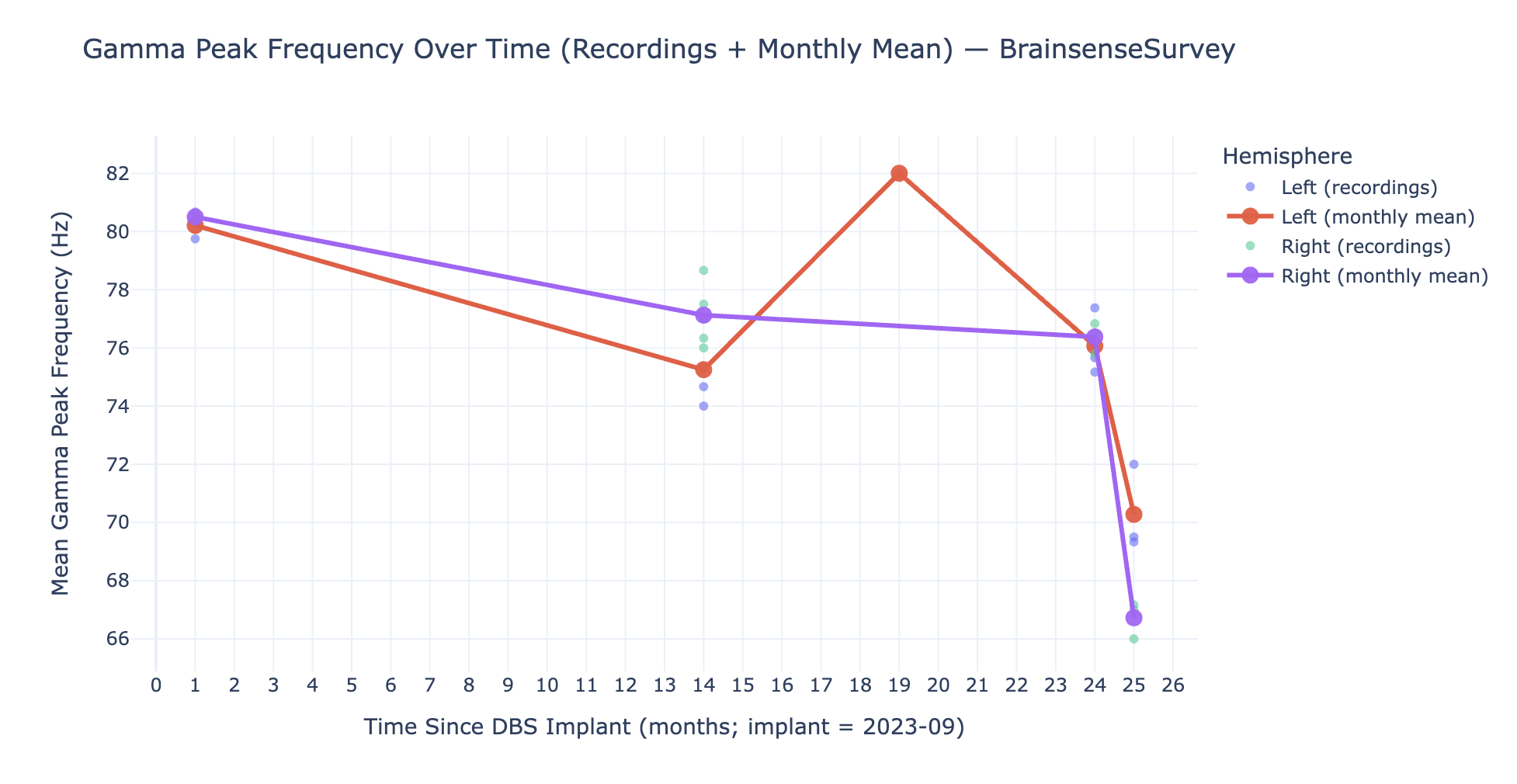 Gamma Peak Frequency Over Time
