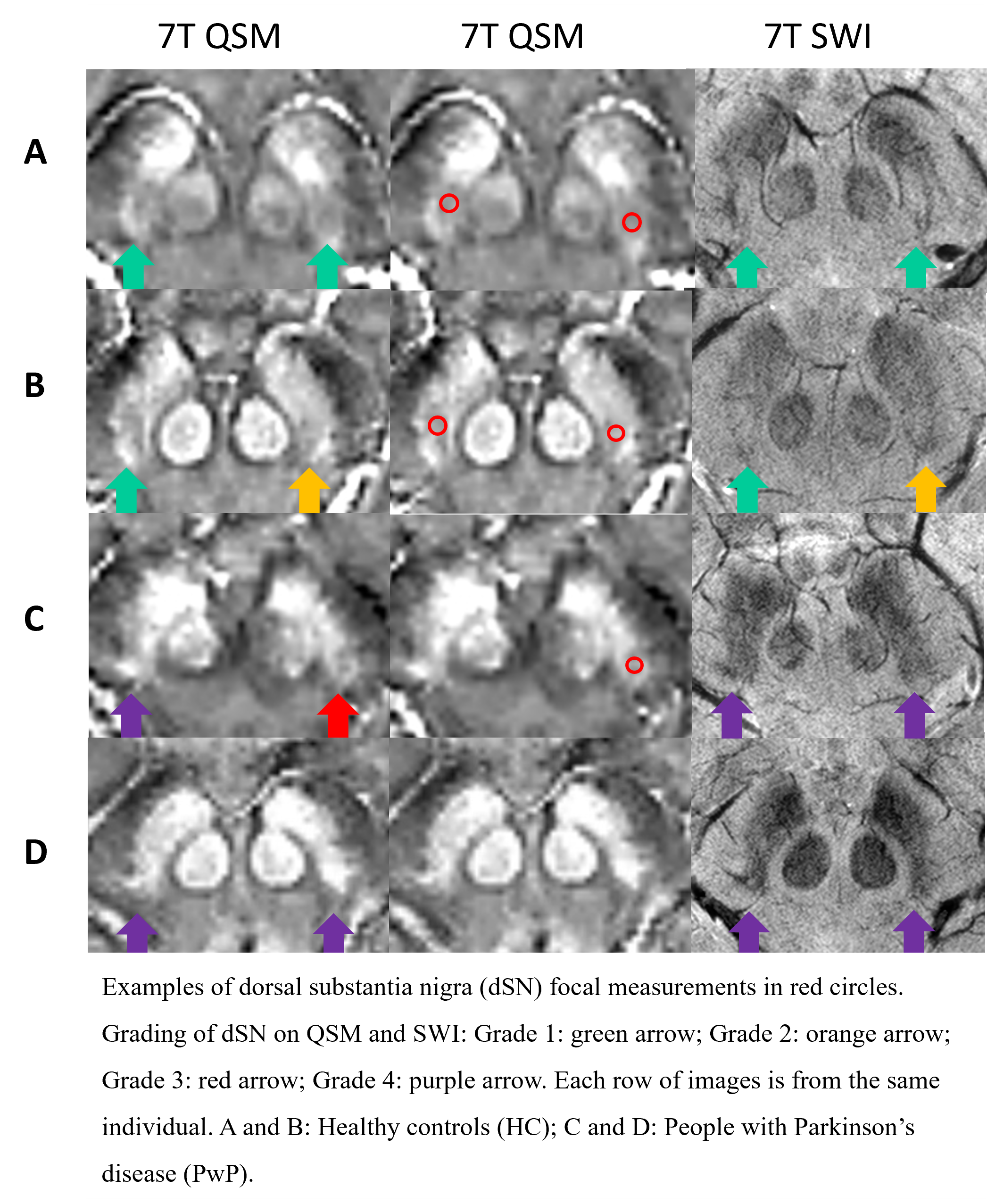 Figure 2 - Focal measurements and grading