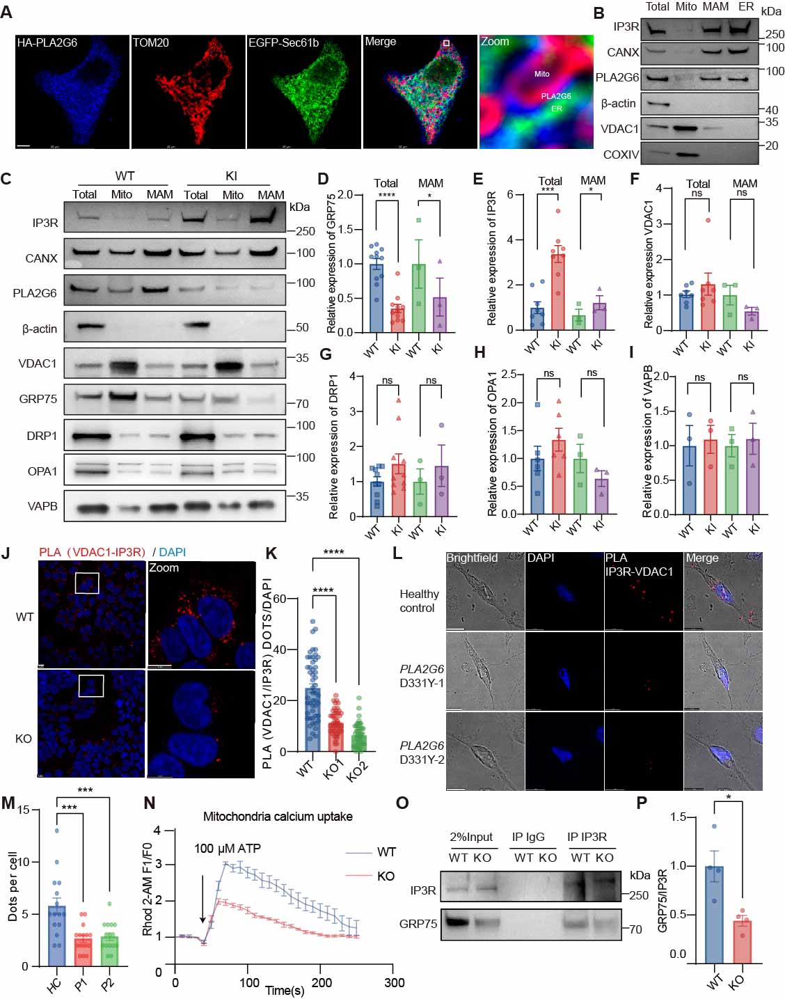PLA2G6 deficiency impairs the IP3R-GRP75-VDAC1