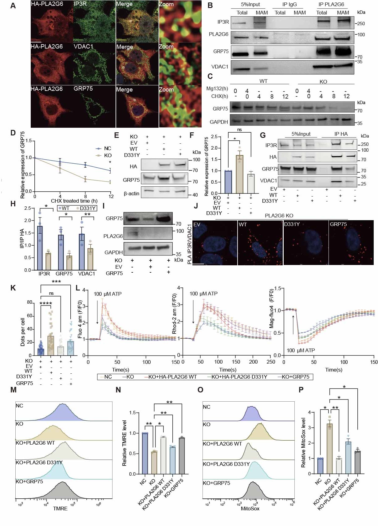 GRP75 overexpression