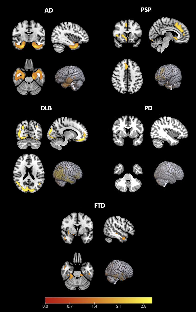 Voxel-wise FDG-PET patterns across groups