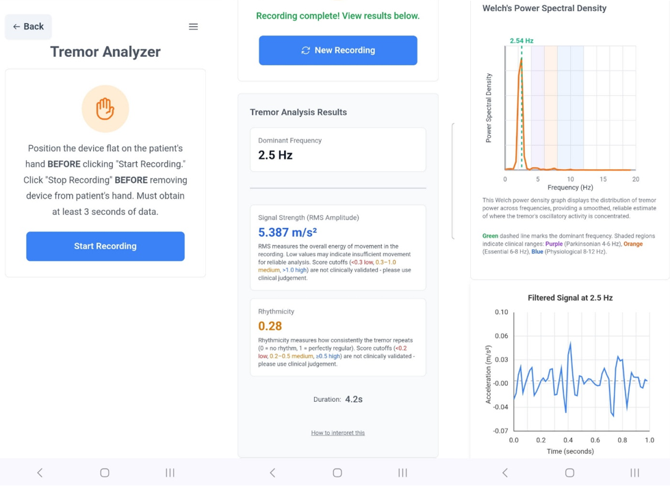 Screenshots of Tremor Analyzer