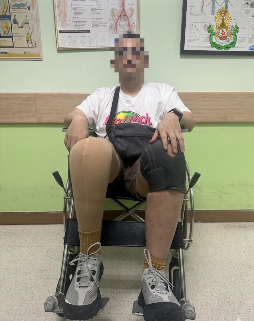 Figure 5. Movement resolved, 2-year remission