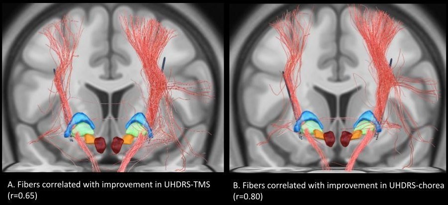Fiber-based correlation analysis