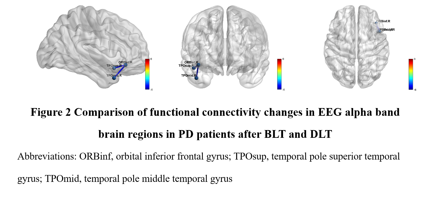 Effect of BLT on regional brain FC