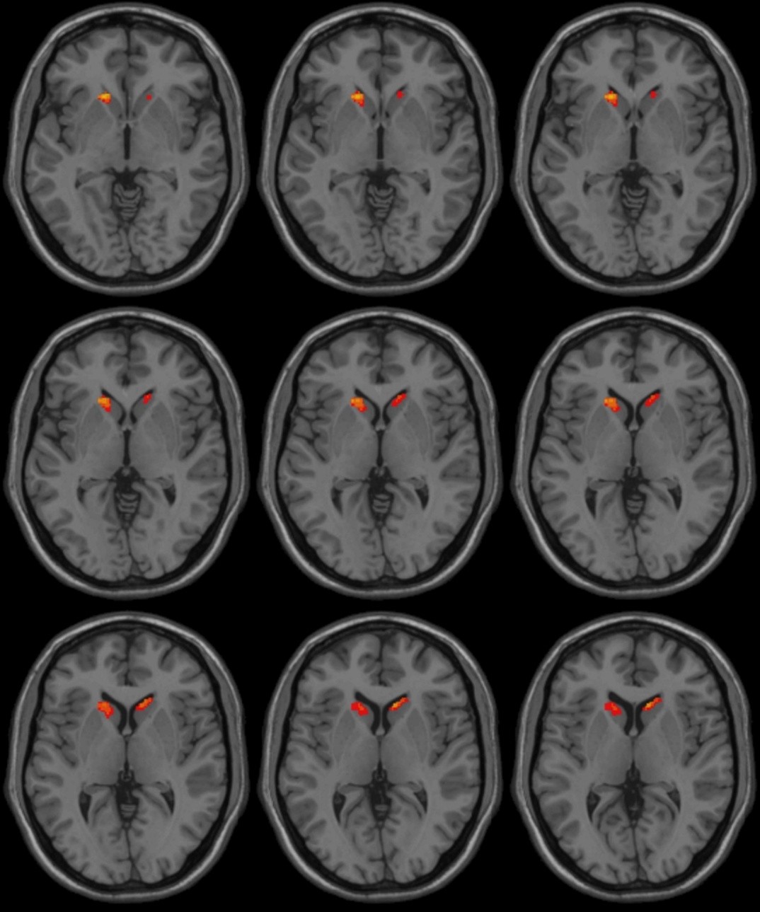 Fig.1