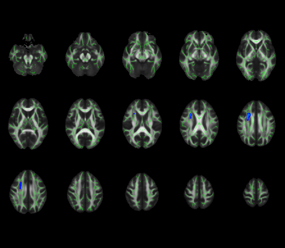 Fig.2