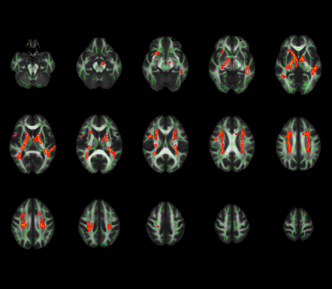 Fig.3