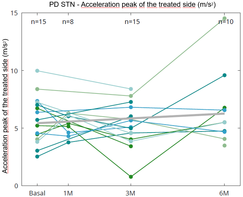Accel. peak of the treated side of PD STN