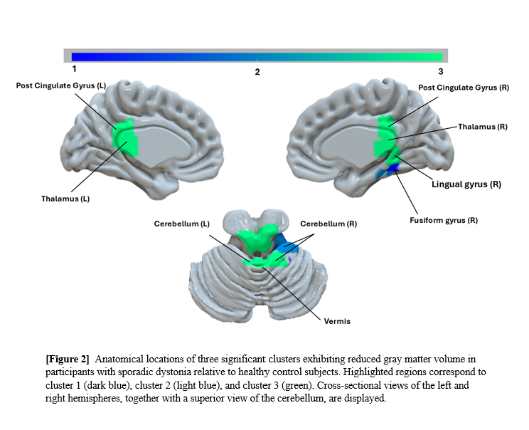 Anatomical locations of cluster brain regions