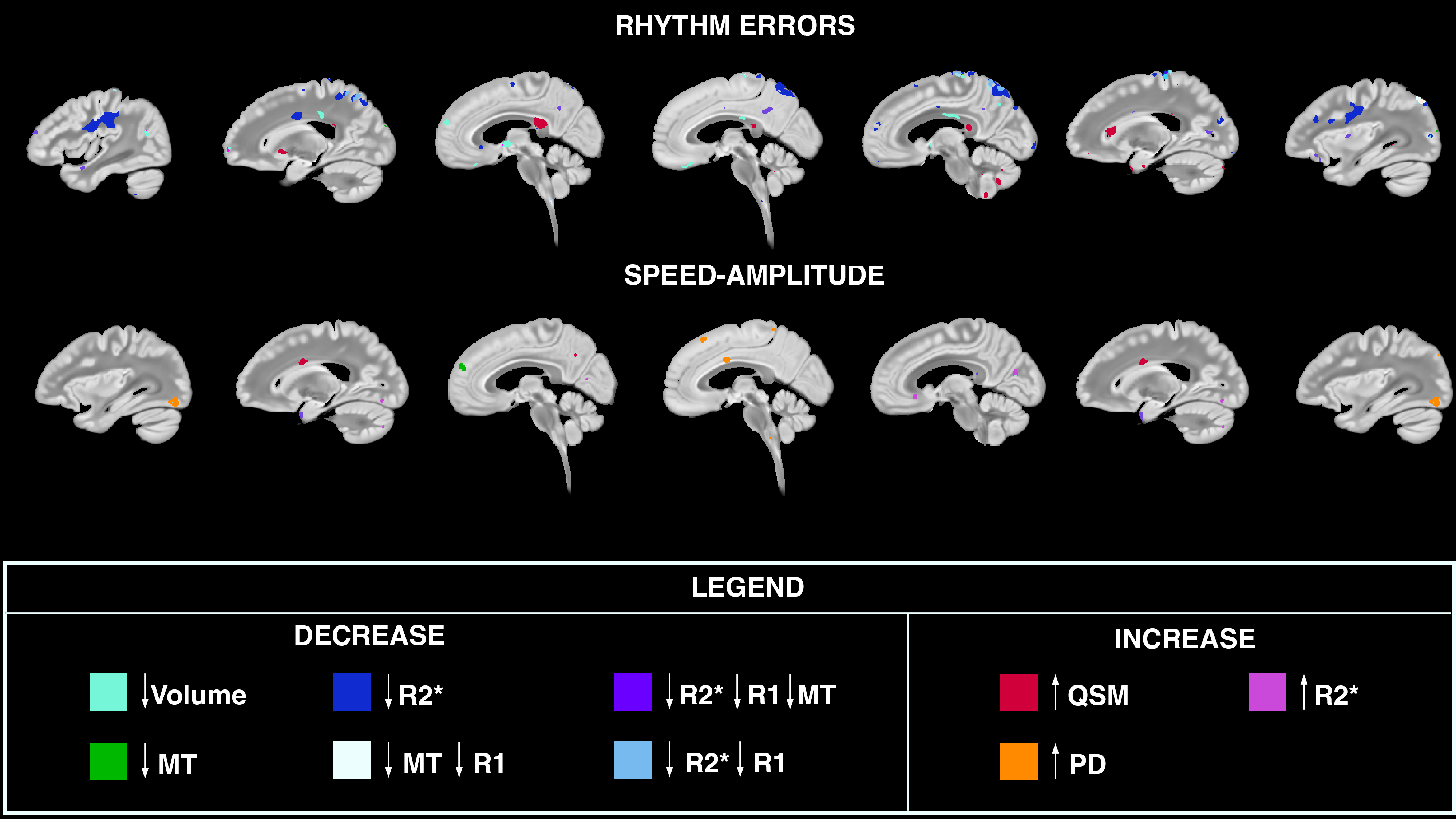 Rhythm errors and speed-amplitude analysis