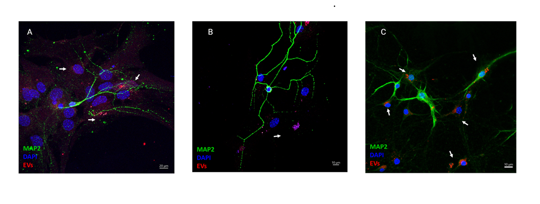 Confocal Images of EV Uptake in Cultures