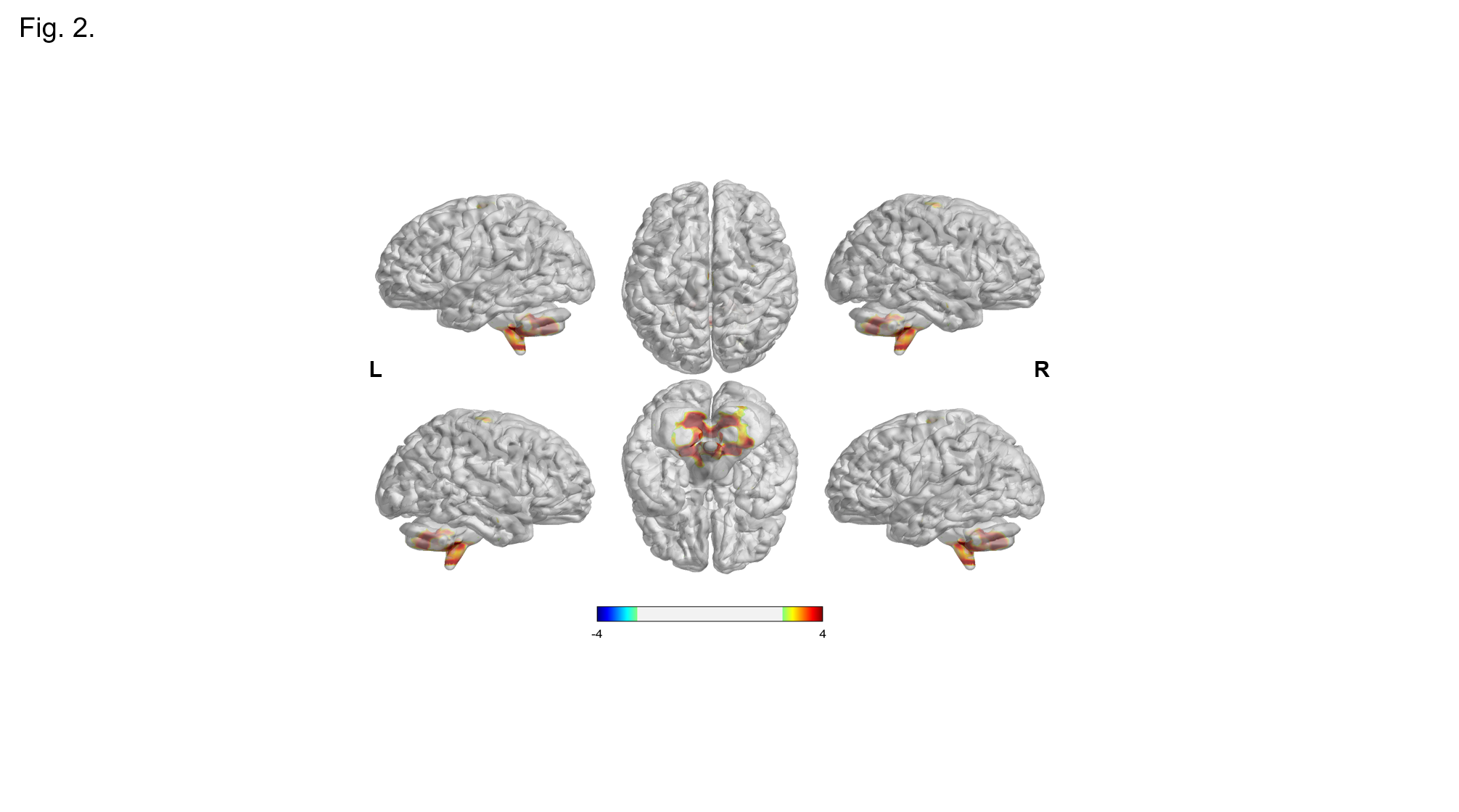 Fig.2 functional connectivity analysis.