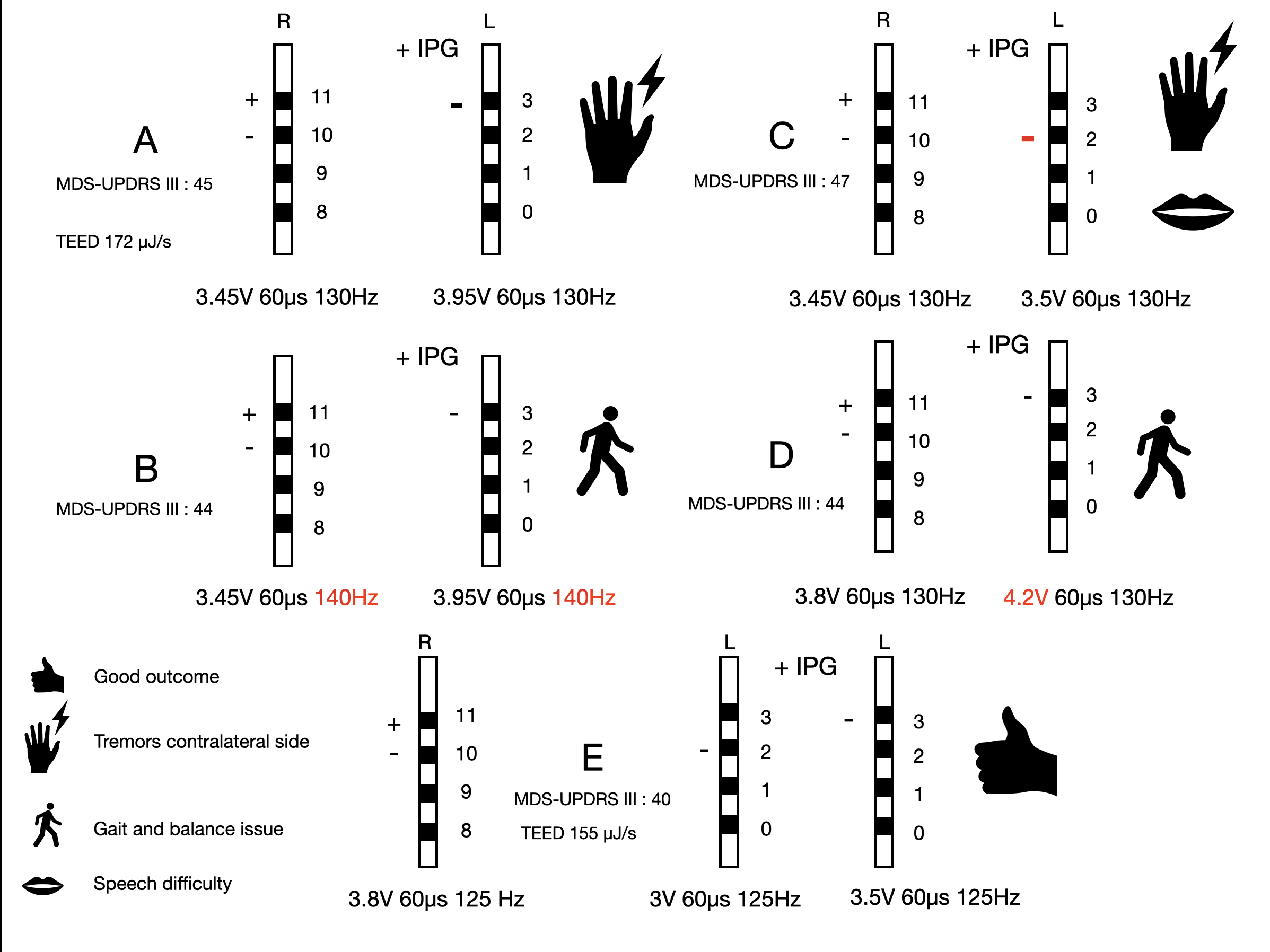 Variable DBS settings, clinical outcome and TEED