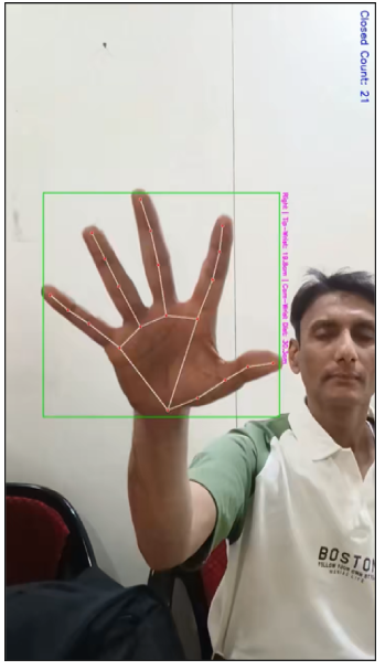 Bradykinesia analysis