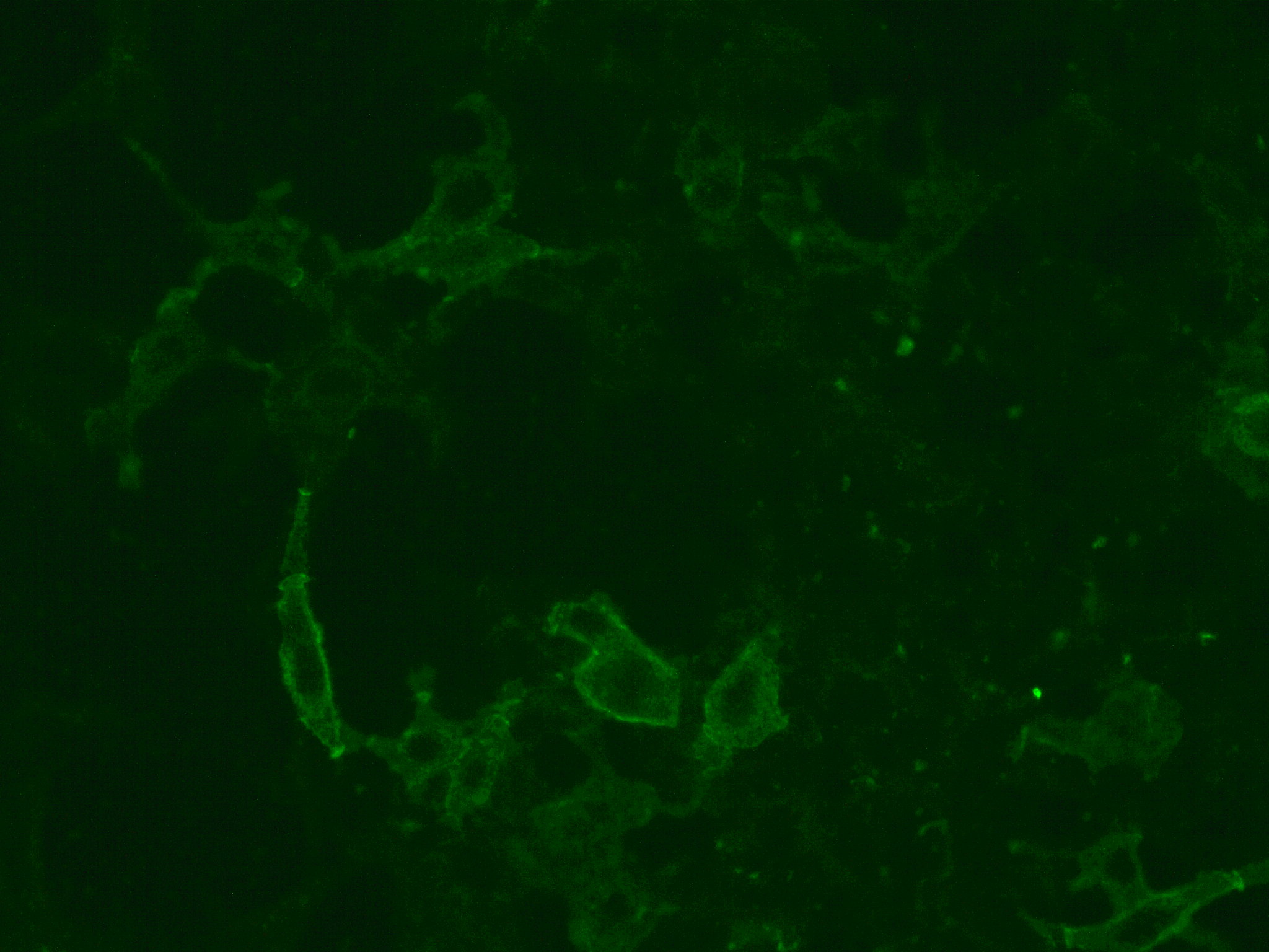 Anti-CASPR2 Ab