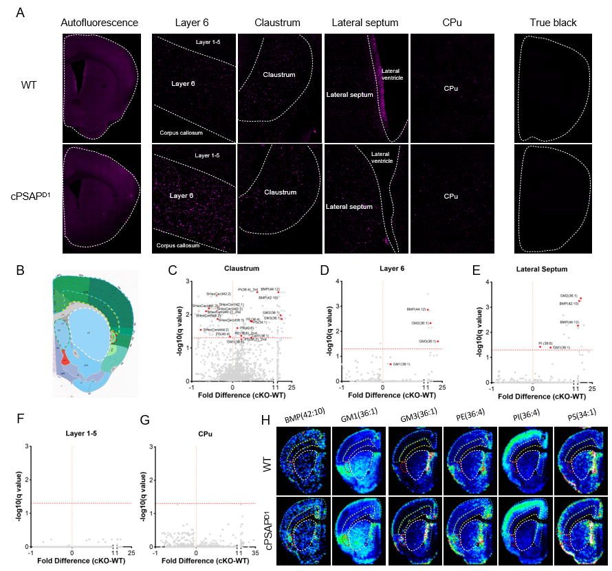 Disrupted lipid metabolism of cPSAPD1 mice