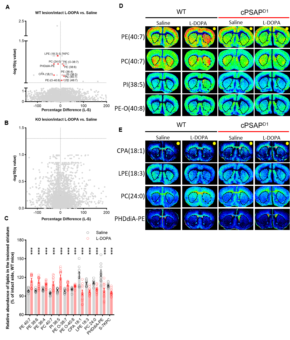 Lipid metabolism of WT and cPSAPD1 LID mice