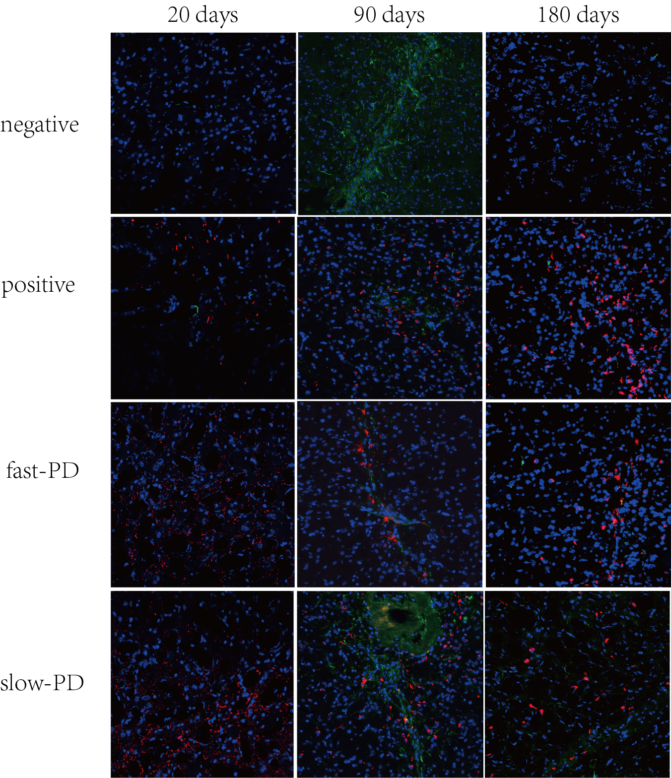 α-Syn pathology and astrocyte reactivity
