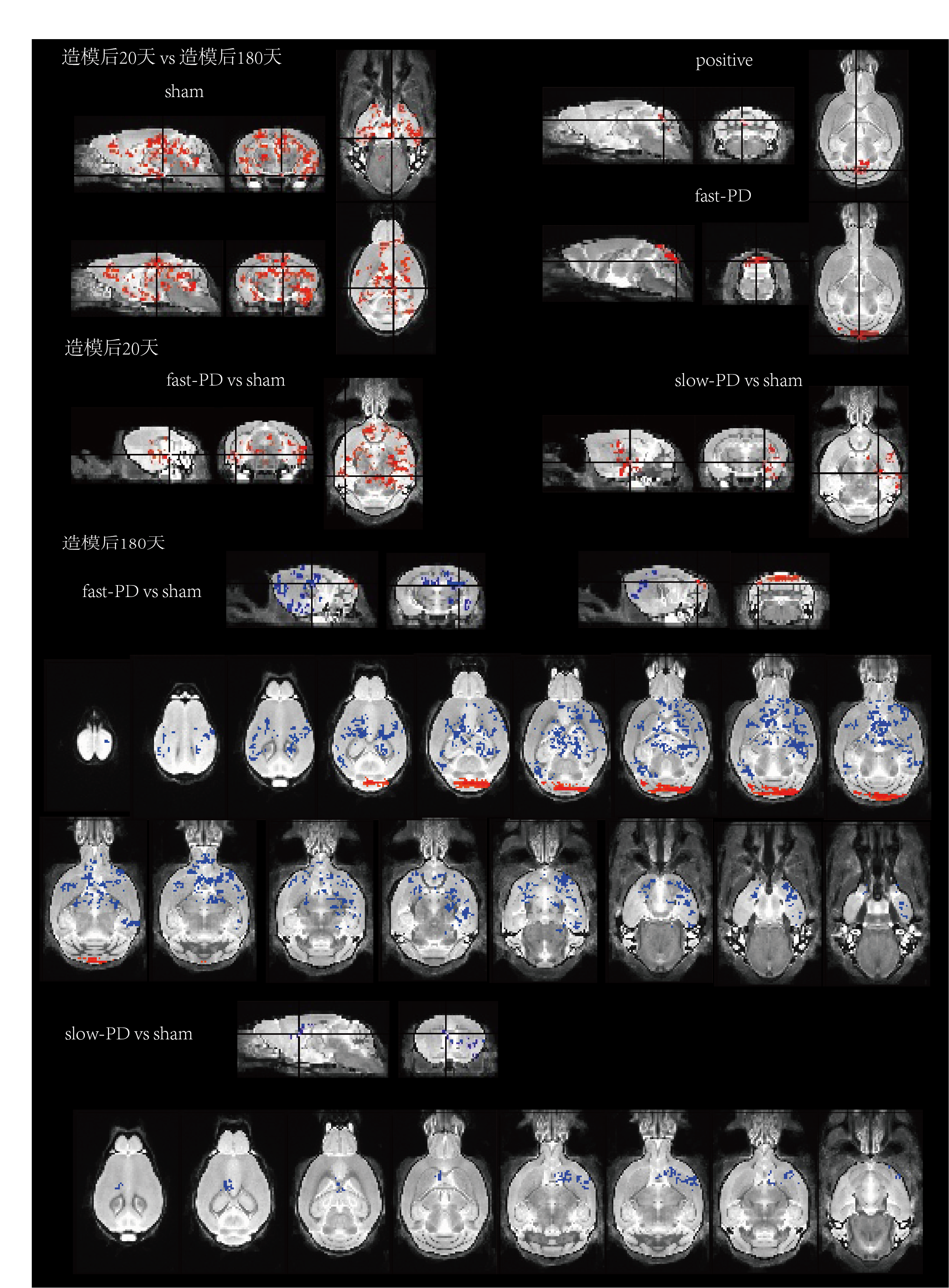 ALFF comparison results