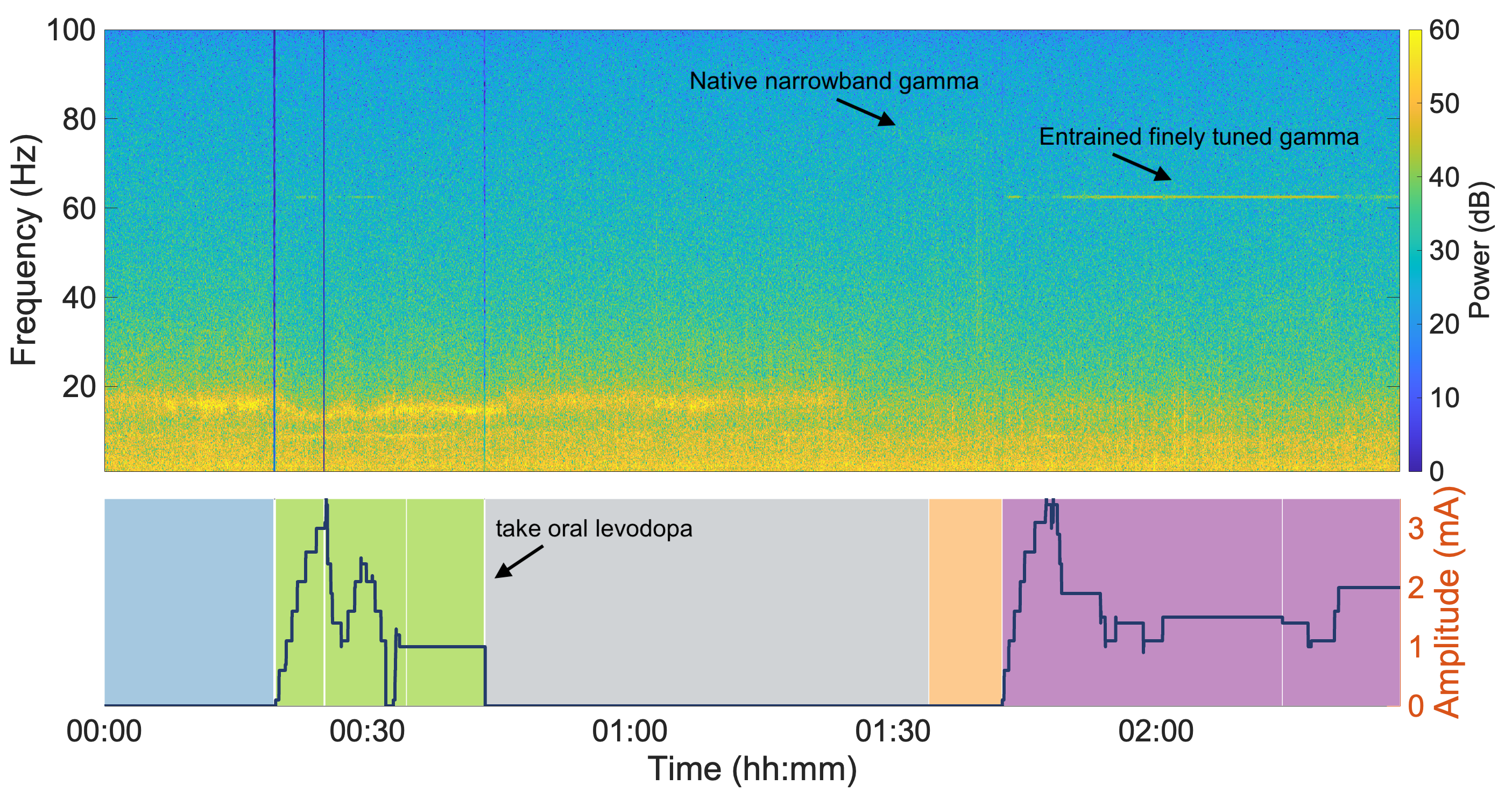 FTG activity at half of stim frequency in the GPi