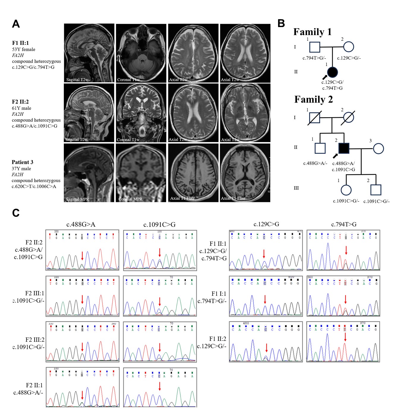 MRI and Genetics