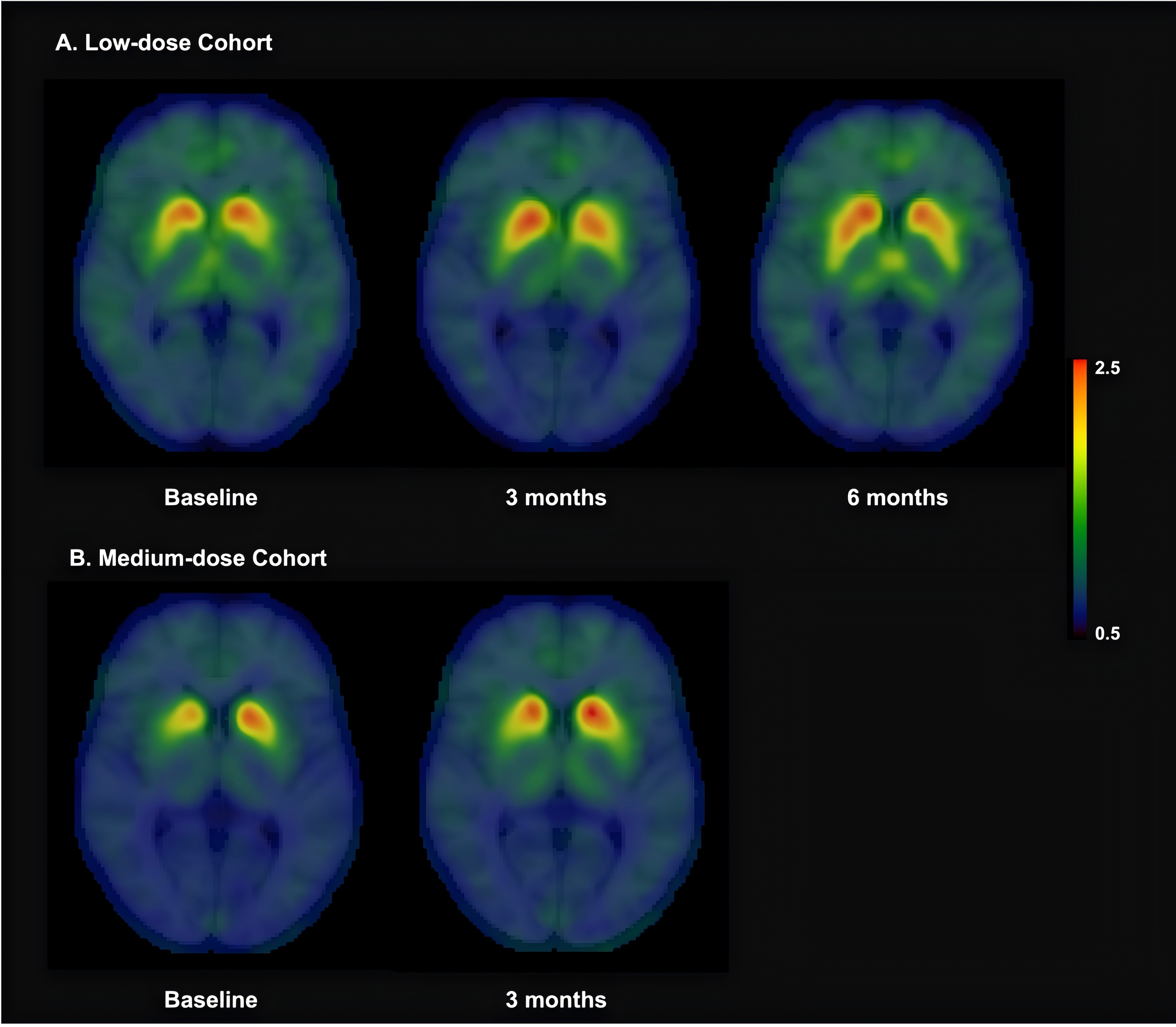 Figure 3 Mean SUVR image
