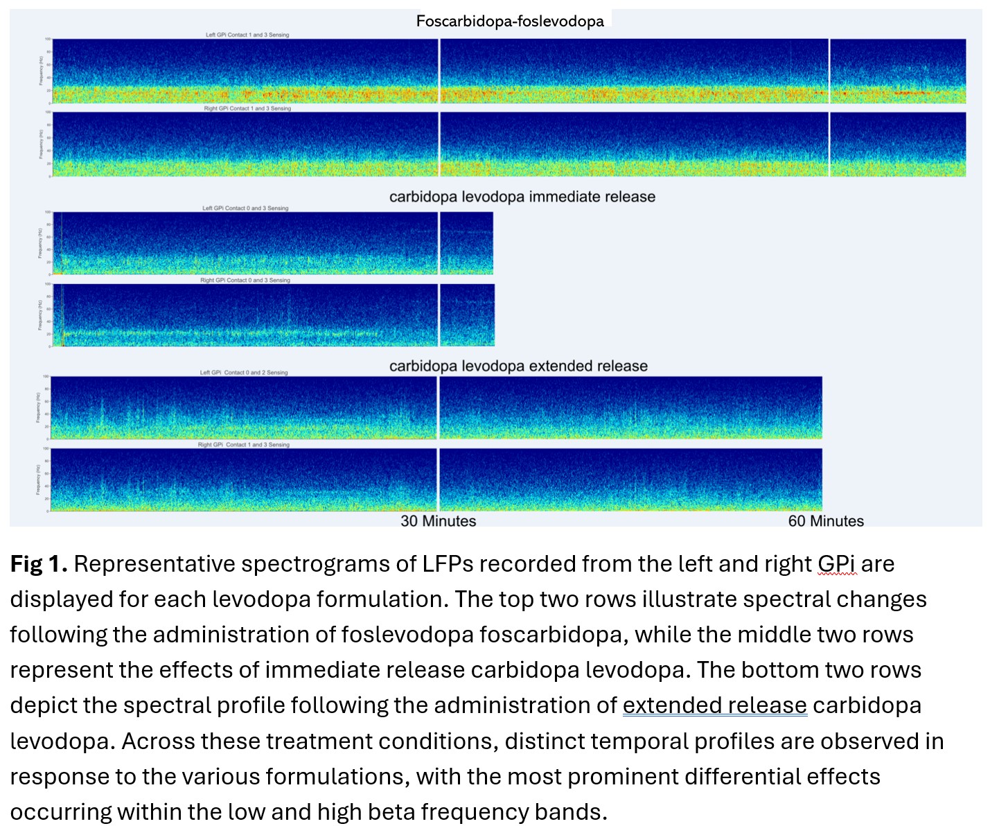 Figure 1 - Levodopa LFP Comparison