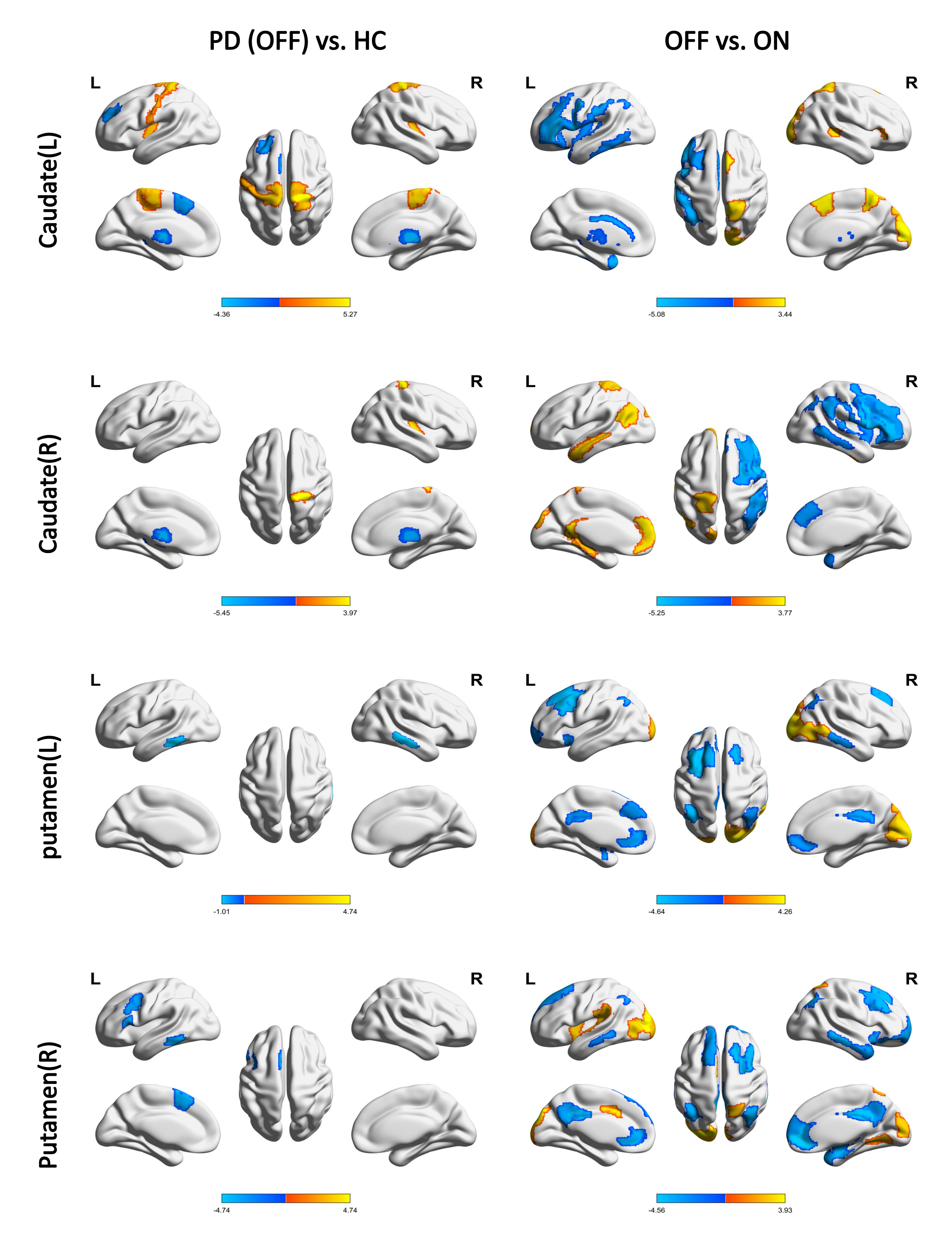 Figure 3. Seed-based connectivity changes