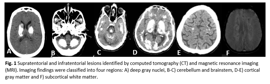 Supratentorial and Infratentorial Lesions (CT/MRI)