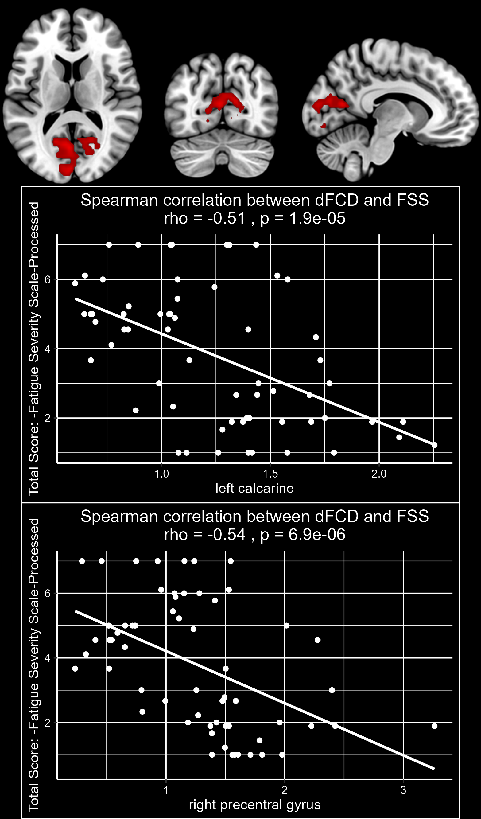 Figure 1: Fatigue-related dFCD in PD