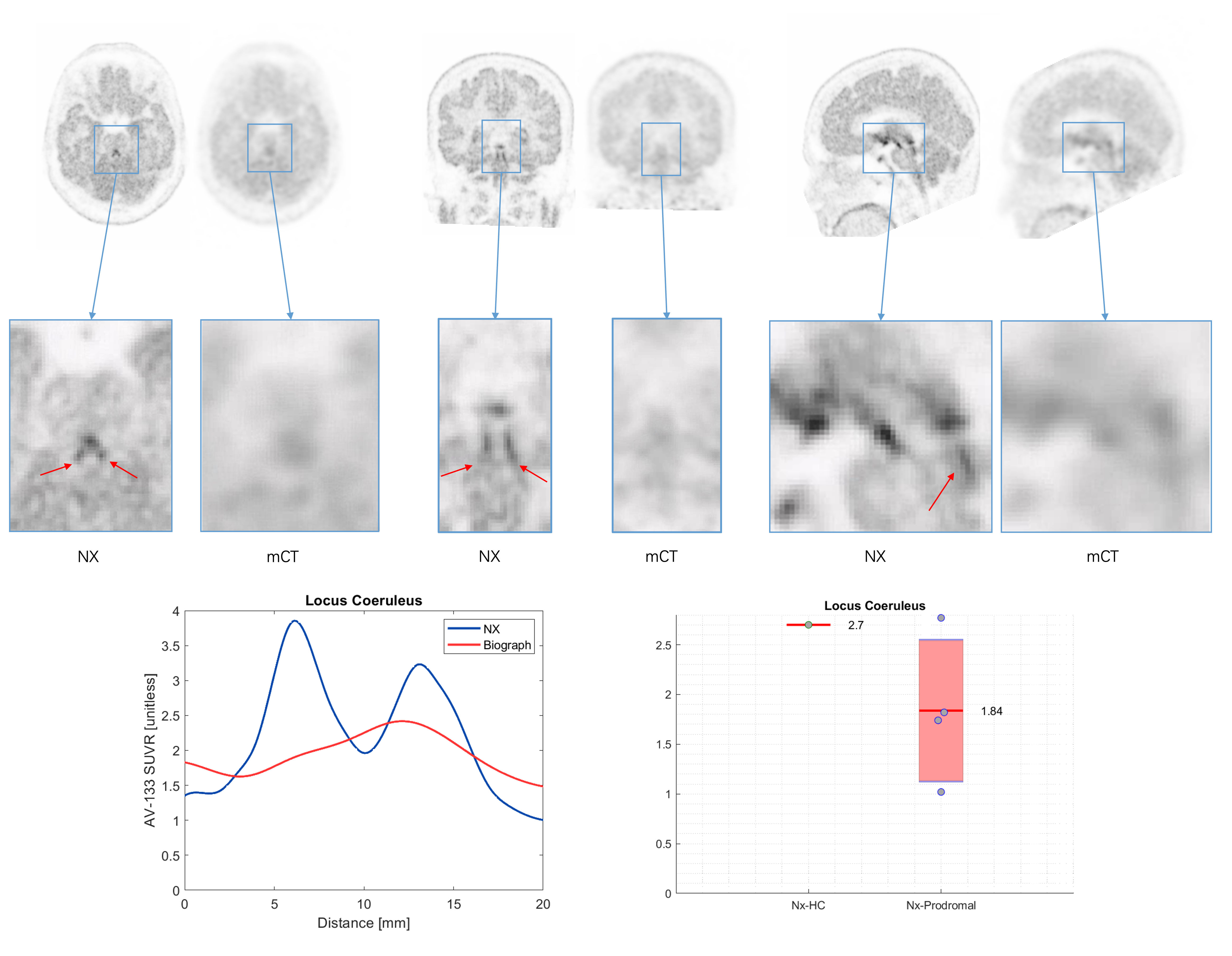 Fig 1: 18F-AV133 imaging on NX and mCT - LC cut.