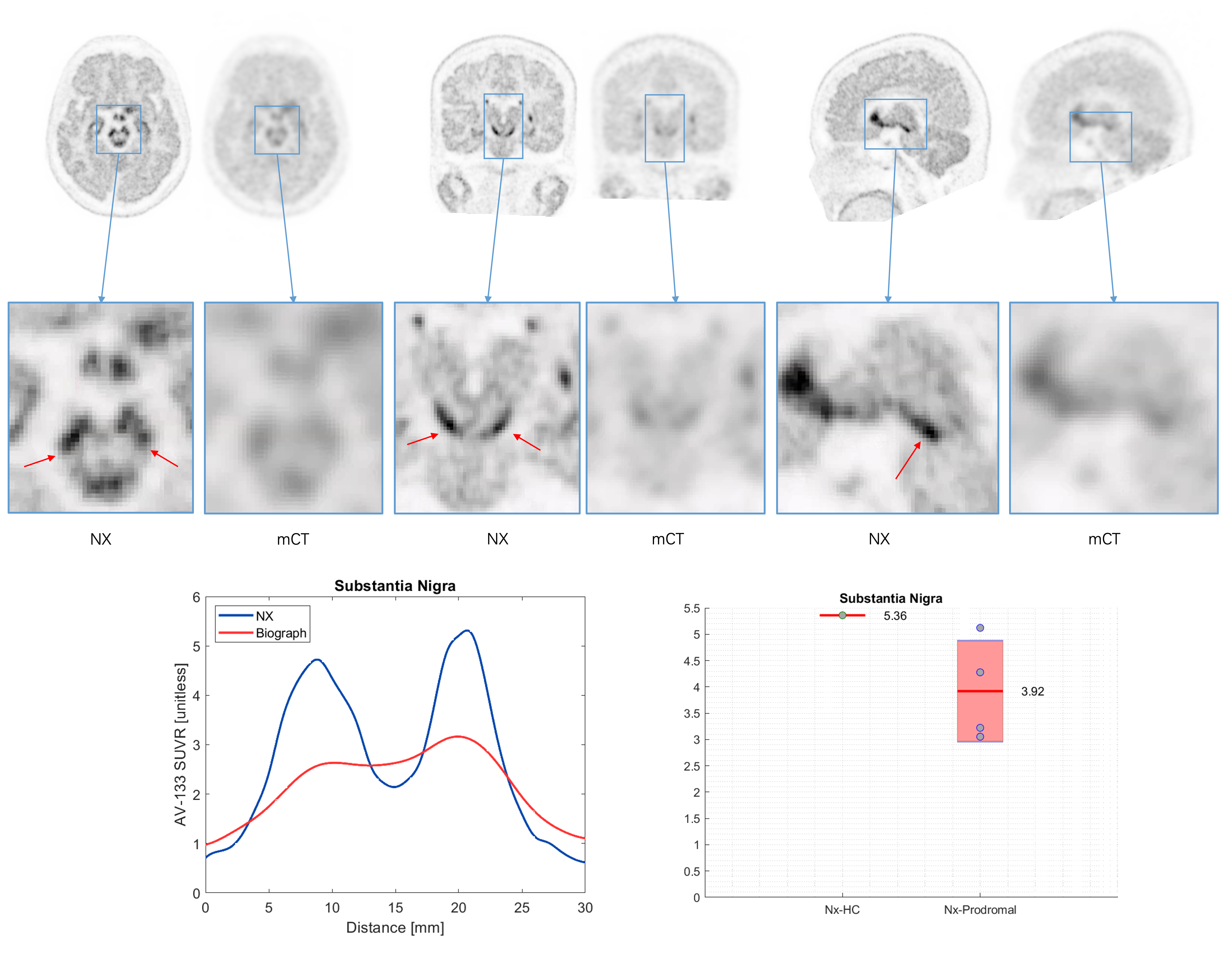 Fig 2: 18F-AV133 imaging on NX and mCT - SN cut.