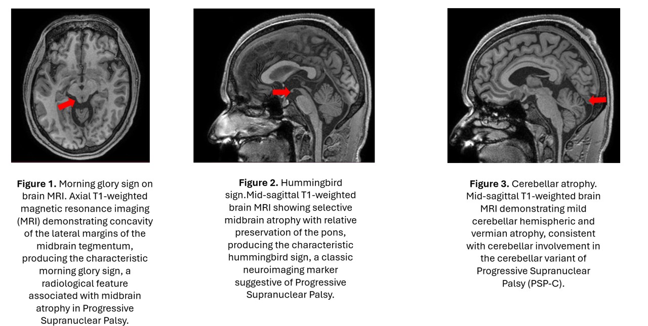 Figures 1, Figure 2, Figure 3