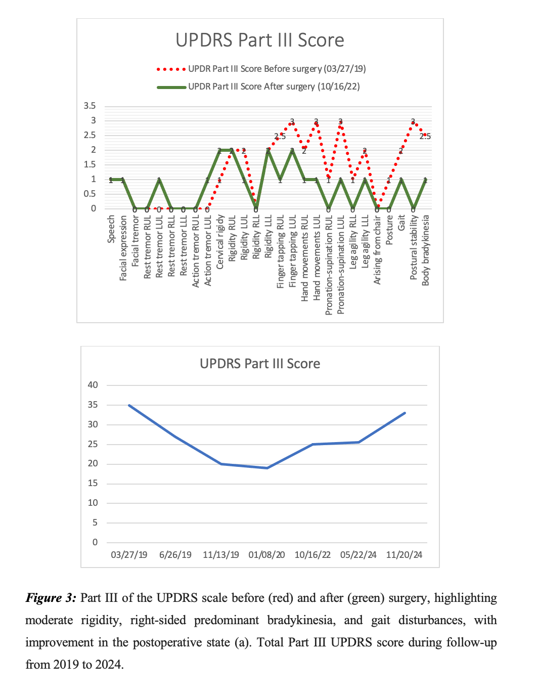 UPDRS III scale before and after surgery